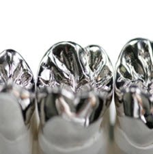 metal crown by dentist brisbane