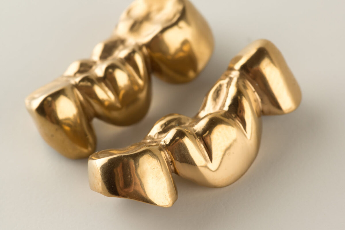 Gold tooth crown