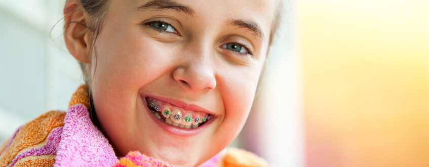 Is My Child Going To Have Braces In Brisbane