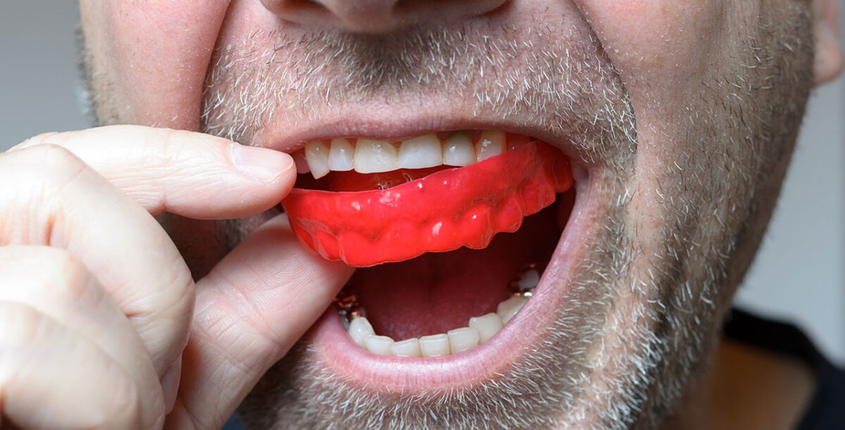Mouthguard dentists in brisbane