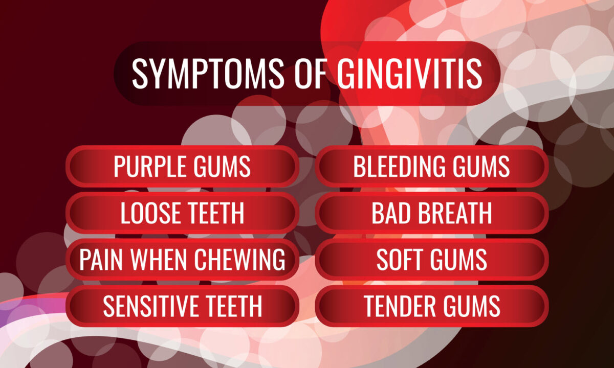 symptoms of Gingivitis